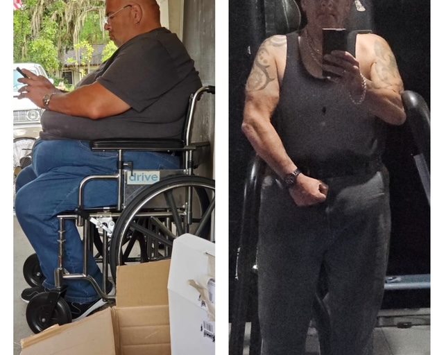 Tony Before and After Dr. Lange's Help